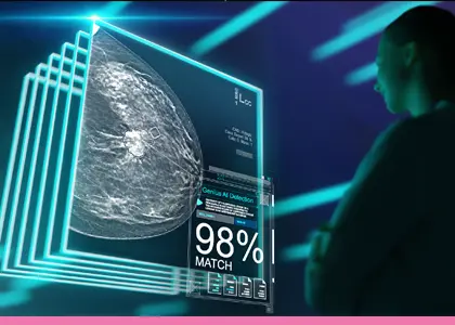 Hologic Genius AI - Early Breast Cancer Detection by Medsource Imaging